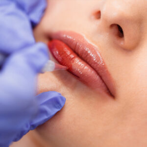 Las diferentes técnicas utilizadas en la micropigmentación de labios