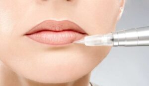 Micropigmentación de labios para cicatrices y decoloración