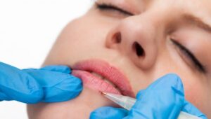 Cómo elegir el color adecuado para la micropigmentación de labios